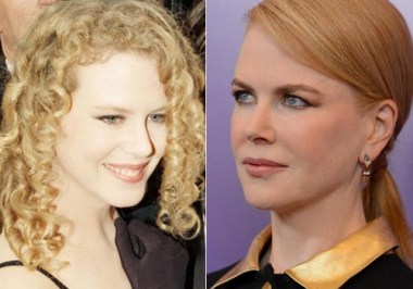 I Vip Con Il Naso Rifatto Sara Vero Meglio Prima O Dopo Dilei