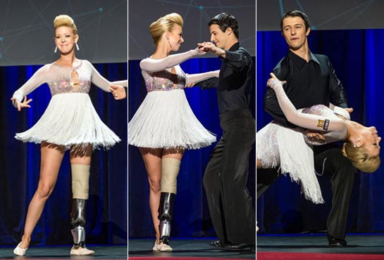 Berlusconi piersilvio salusmaster toto1 modificato protesi La ballerina che perse gamba nell’attentato di Boston torna a danzare