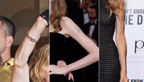 Braccia da horror: dalla Jolie alla Parker. Anoressia o troppa attività fisica?