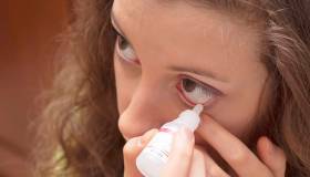 Quali sono i migliori rimedi naturali per curare l’orzaiolo