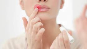 Herpes labiale: ecco i migliori rimedi naturali