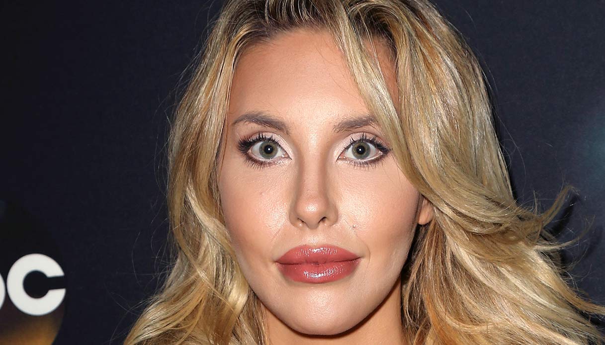 Chloe Lattanzi, figlia di Olivia Newton-John che ha speso 500mila euro in chirurgia