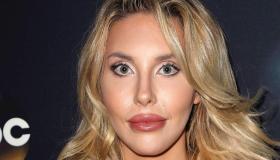 Chloe Lattanzi, figlia di Olivia Newton-John che ha speso 500mila euro in chirurgia