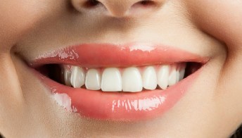 Denti bianchi: 5 regole fai da te per un sorriso splendente