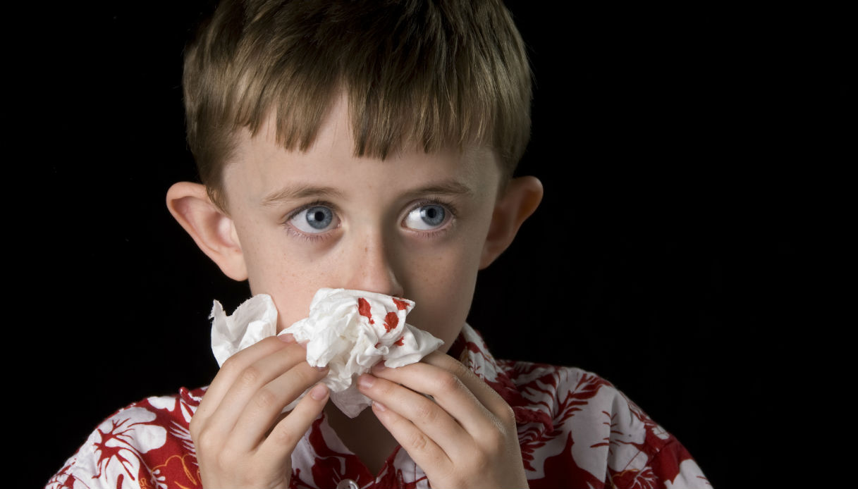 Cosa Fare Quando Perdi Sangue Dal Naso