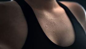 Le patologie della sudorazione: bromidrosi, ipoidrosi, iperidrosi e ematoidrosi