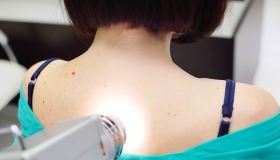 Cheratosi: cos’è, manifestazioni e cure