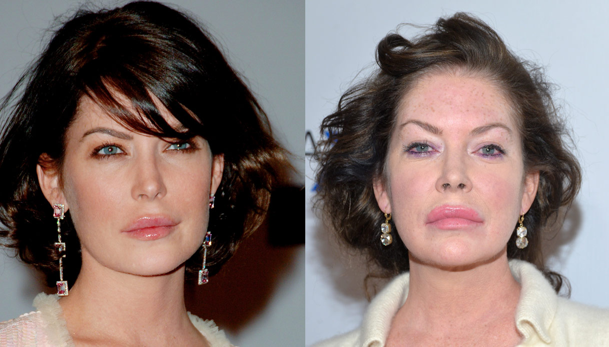Lara Flynn Boyle: chi ha rovinato la migliore amica di Laura Palmer?