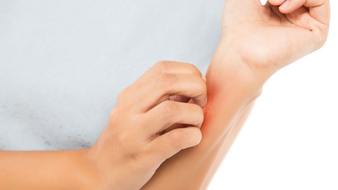Dermatite atopica: cos’è, cause, sintomi e cure