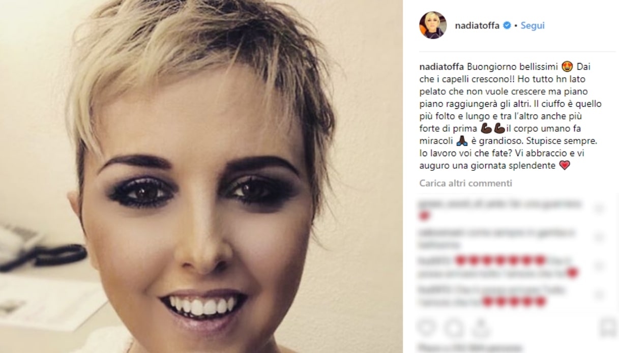 Nadia Toffa senza parrucca su Instagram: “I capelli stanno ricrescendo più  forti di prima” | DiLei