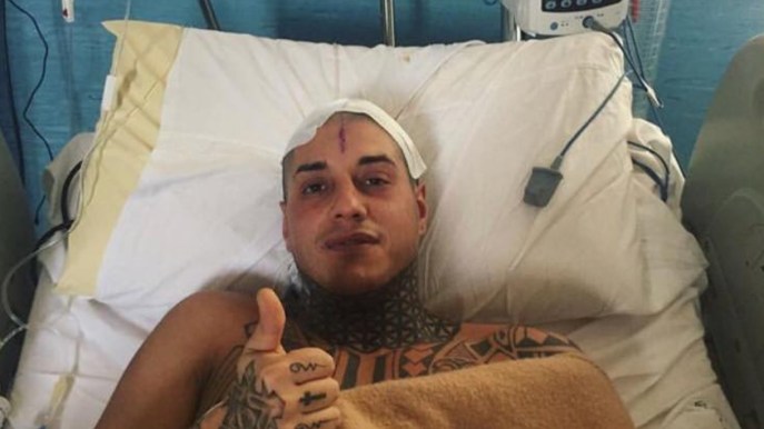 Francesco Chiofalo, prima foto dopo l’operazione: “Ce l’ho fatta”. E l’ex lo attacca