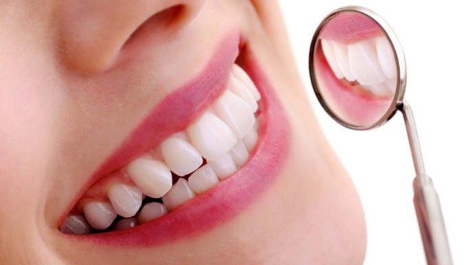 Denti, gli effetti collaterali dei prodotti sbiancanti