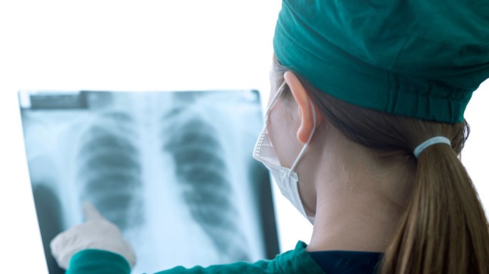 Come si previene e come si affronta il tumore polmonare