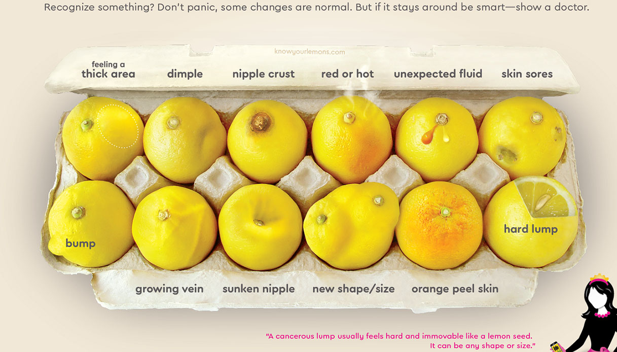 Cancro al seno: la campagna che usa i limoni per imparare a riconoscere i sintomi