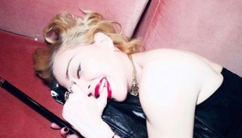 Madonna, topless e stampella: “Ognuno ha la sua”