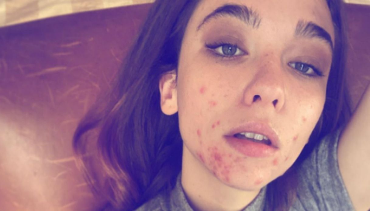 Matilda De Angelis su Instagram mostra il viso senza trucco: “Per accettarmi”