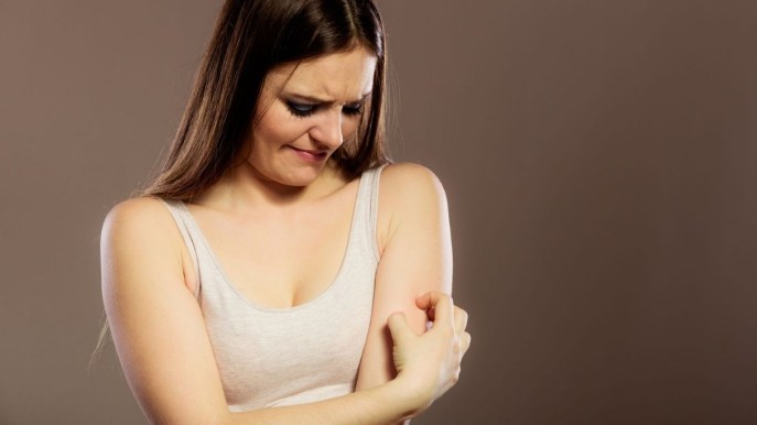 Dermatite seborroica: sintomi, cause e trattamento