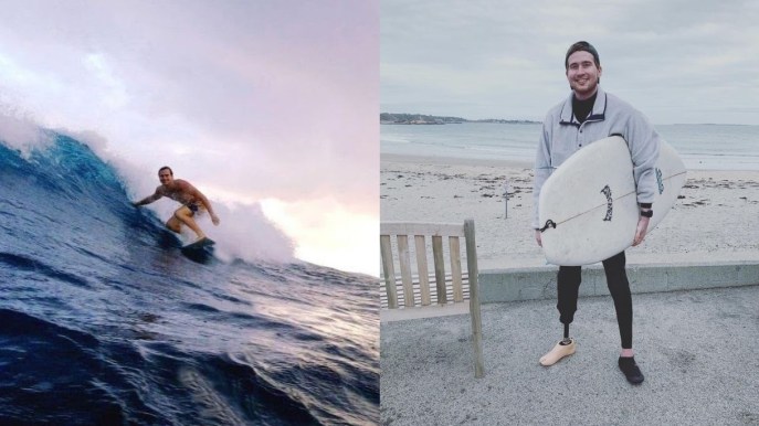Carter Parry: “Ricomincio dal surf, senza una gamba e un polmone”