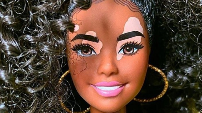 Barbie con la vitiligine: attenzione a semplificare. Intervista all’esperto