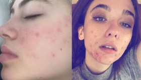 Leni, Matilda, Aurora e il coraggio di mostrarsi imperfette