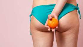 Cellulite: rimedi ed esercizi per combatterla