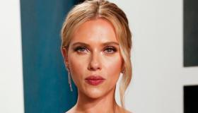 Strabismo di Venere, le star che lo hanno reso un dettaglio ricco di fascino