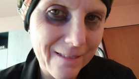 L’appello di Daniela è stato ascoltato: sua madre l’aiuterà nella lotta contro il cancro