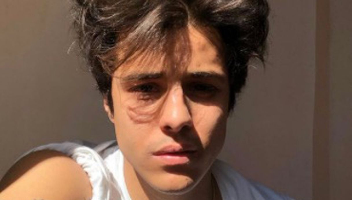 Michele Merlo, parla il medico che l’ha respinto: il dolore dei genitori