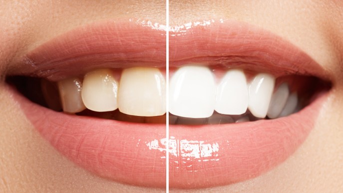Denti bianchi e sorriso perfetto: i consigli della specialista