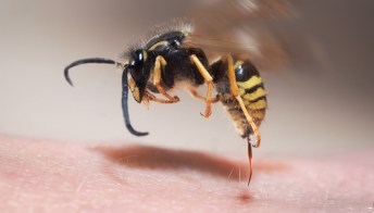 Allergia da puntura di api, vespe e calabroni, come ridurre i rischi