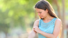 Zanzare, perché non pungono solo chi ha il “sangue dolce”