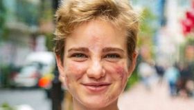 Bebe Vio, lo stafilococco, la paura e il trionfo: “Ecco perché ho pianto così tanto”