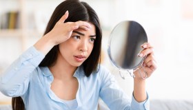 Pelle grassa e acne: attenzione agli zuccheri