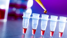 Tumori del sangue, le sfide del futuro per vincerli