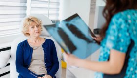 Tumore del polmone, chi rischia di più e le cure personalizzate