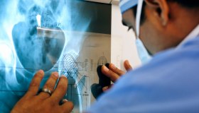 Chirurgia Ortopedica Protesica: perché scegliere il Gruppo Giomi