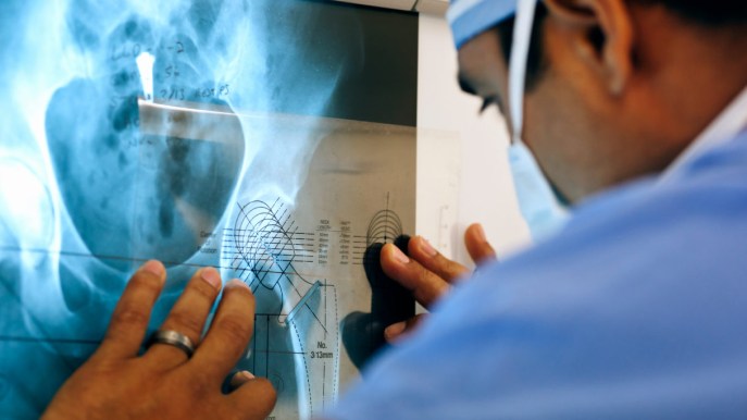 Chirurgia Ortopedica Protesica: perché scegliere il Gruppo Giomi