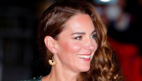 Kate Middleton, il magico botox organico anti-rughe costa meno di 50 euro