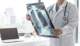 Diagnosi precoce, obiettivo chiave per curare ancor meglio il tumore del polmone