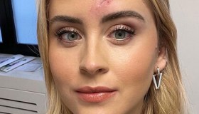 Valentina Ferragni, le prime parole dopo l’operazione: “Era un tumore”