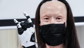 Valentina Pitzalis, forte come Wonder Woman: un esempio di vita