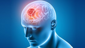 Come nasce un tumore e cosa accade alle cellule sane