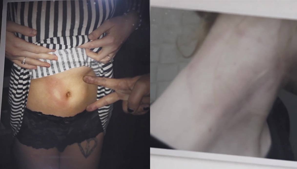 Evan Rachel Wood: le foto degli abusi subiti da Manson