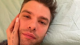 “Non c’è nulla di brutto in una cicatrice”. La foto di Fedez su Instagram dopo l’operazione