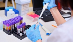 Medicina predittiva, il ruolo della genetica nello sviluppo di un tumore