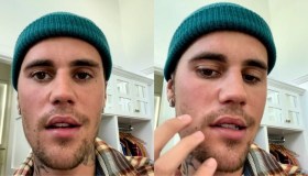 Justin Bieber e la malattia: “Ho una paralisi facciale”. I veri motivi dello stop al tour