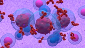 Mieloma multiplo: sintomi, diagnosi e cure