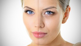 Il trattamento ai fili di collagene che leviga le rughe meglio del Botox