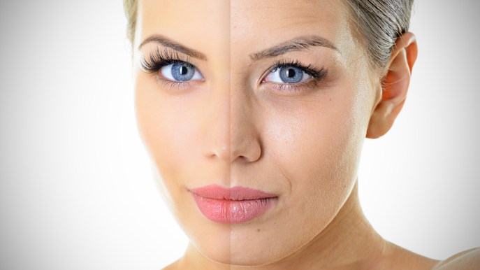 Il trattamento ai fili di collagene che leviga le rughe meglio del Botox