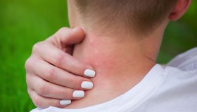 Virus del Nilo Occidentale, 10 cose che bisogna sapere